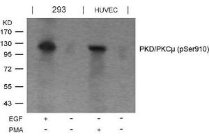 Western blot analysis of extracts from EGF-treated 293 and PMA-treated HUVEC cells using PKD/PKCm(Phospho-Ser910) Antibody. (PKC mu antibody  (pSer910))