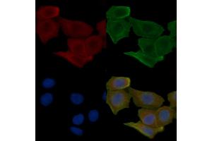 ABIN6257995 and ABIN6275571 staining Hela cells(30 min of UV treatment) by IF/ICC. (SIRPB1 antibody  (Internal Region))