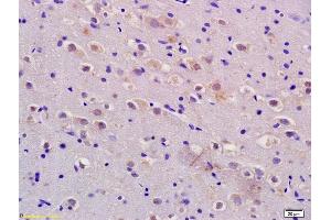 Formalin-fixed and paraffin embedded rat brain labeled with Anti-ADM/AM/Adrenomedullin Polyclonal Antibody, Unconjugated (ABIN723515) at 1:200 followed by conjugation to the secondary antibody and DAB staining.