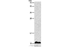 Western blot analysis of Human fetal liver tissue, using APOC1 Polyclonal Antibody at dilution of 1:500 (APOC1 antibody)
