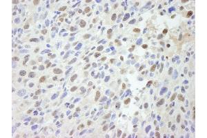 Immunohistochemistry (IHC) image for anti-Mediator Complex Subunit 12 (MED12) (C-Term) antibody (ABIN7448660)