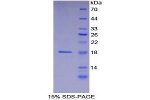 SDS-PAGE (SDS) image for Laminin, alpha 1 (LAMA1) (AA 886-1039) protein (His tag) (ABIN1080203) (Laminin alpha 1 Protein (AA 886-1039) (His tag))
