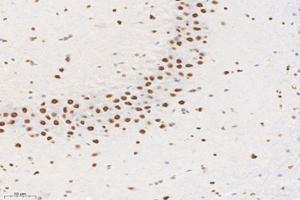 Immunohistochemistry analysis of paraffin-embedded rat brain using,SET (ABIN7075583) at dilution of 1: 10000 (SET/TAF-I antibody)