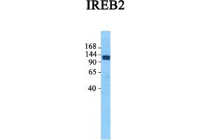 Host:  Rabbit  Target Name:  IREB2  Sample Tissue:  Human Fetal Lung  Antibody Dilution:  1. (IREB2 antibody  (Middle Region))
