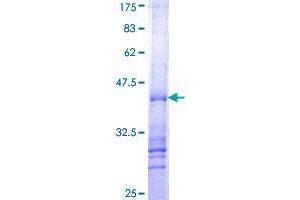 RNF168 Protein (AA 462-571) (GST tag)
