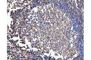 IHC analysis of MRC1 using anti-MRC1 antibody (ABIN7600593).
