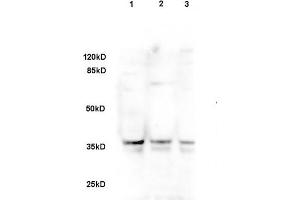 Sheep fat cell lysate 30ug, probed with Rabbit Anti-DLK1/DLL1 Polyclonal Antibody (ABIN740055) at 1:200 overnight in 4 °C. (DLK1 antibody  (AA 251-350))
