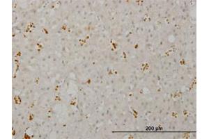 Image no. 1 for anti-pi-3-Kinase-Related Kinase SMG-1 (SMG1) (AA 2922-3032) antibody (ABIN599192) (SMG1 antibody  (AA 2922-3032))