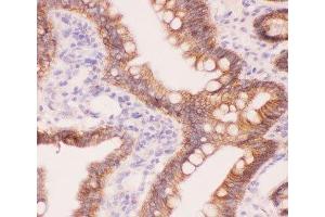 IHC-P staining of rat intestine tissue (CTNNA1 antibody  (AA 143-292))