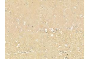ABIN6259339 and ABIN6275439 at 1/100 staining human normal gastric tissue by IHC-P. (RSAD1 antibody  (Internal Region))