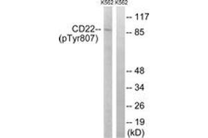 Western blot analysis of extracts from K562 cells treated with Na3VO4 0. (CD22 antibody  (pTyr807))