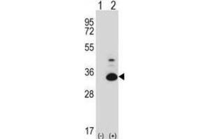 Western Blotting (WB) image for anti-TP53 Regulating Kinase (TP53RK) antibody (ABIN2997879) (TP53RK antibody)