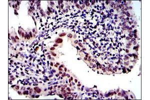 Immunohistochemistry (IHC) image for anti-Proteasome (Prosome, Macropain) Subunit, beta Type, 8 (Large Multifunctional Peptidase 7) (PSMB8) antibody (ABIN969371)