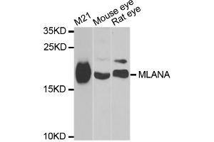 Western blot analysis of extracts of various cell lines, using MLANA antibody (ABIN5973714) at 1/1000 dilution. (MLANA antibody)
