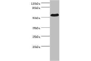 Western blot All lanes: PSEN1 antibody at 2 μg/mL + Hela whole cell lysate Secondary Goat polyclonal to rabbit IgG at 1/10000 dilution Predicted band size: 53, 43, 22, 47, 49 kDa Observed band size: 53 kDa (Presenilin 1 antibody  (AA 1-160))