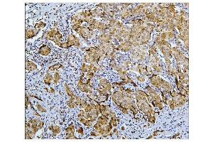 anti-Budding Uninhibited By Benzimidazoles 1 Homolog beta (Yeast) (BUB1B) (AA 26-448) antibody