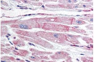 Human Heart (formalin-fixed, paraffin-embedded) stained with BIRC7 antibody ABIN298022 at 10 ug/ml followed by biotinylated anti-mouse IgG secondary antibody ABIN481714, alkaline phosphatase-streptavidin and chromogen. (BIRC7 antibody)