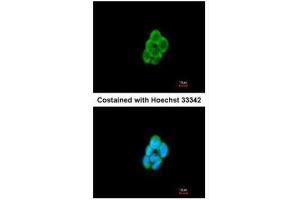 ICC/IF Image Immunofluorescence analysis of methanol-fixed A431, using CMTM6, antibody at 1:200 dilution.