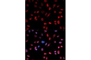 Immunofluorescence analysis of MCF-7 cells using Phospho-ATF2-T71 antibody (ABIN5969881).