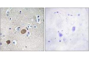 Immunohistochemistry analysis of paraffin-embedded human brain tissue, using Catenin-alpha1 (Ab-641) Antibody. (CTNNA1 antibody  (AA 607-656))
