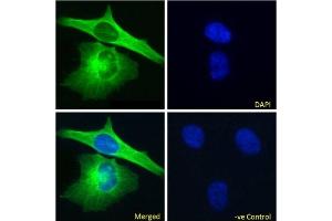 Immunofluoresence staining of fixed HeLa cells with anti-Alpha-tubulin antibody F2C. (Recombinant alpha Tubulin antibody)