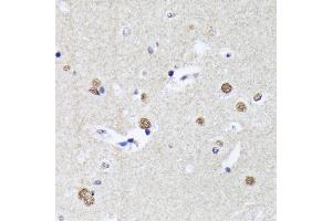 Immunohistochemistry (IHC) image for anti-Matrin 3 (MATR3) antibody (ABIN7268414)