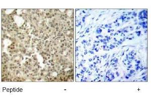 Image no. 1 for anti-Protein Kinase C, delta (PKCd) (AA 643-647) antibody (ABIN197564) (PKC delta antibody  (AA 643-647))