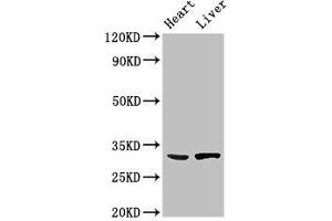 Western Blot Positive WB detected in: Mouse heart tissue, Rat liver tissue All lanes: SDCBP antibody at 3 μg/mL Secondary Goat polyclonal to rabbit IgG at 1/50000 dilution Predicted band size: 33, 32 kDa Observed band size: 33 kDa (SDCBP antibody  (AA 21-228))