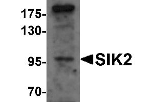 Western blot analysis of SIK2 in SW480 cell lysate with SIK2 antibody at 1 µg/mL. (SIK2 antibody  (Middle Region))