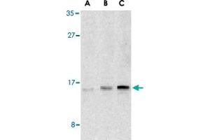 Western blot analysis of UBE2V1 in Jurkat cell lysates with UBE2V1 polyclonal antibody  at (A) 1, (B) 2, and (C) 4 ug/mL . (UBE2V1 antibody  (C-Term))