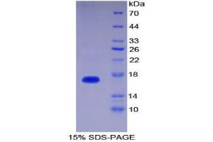SDS-PAGE analysis of Human Interleukin 1 delta Protein. (FIL1d Protein)