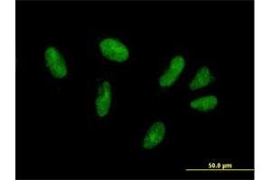 Immunofluorescence of purified MaxPab antibody to ZFP28 on HepG2 cell. (ZFP28 antibody  (AA 1-349))