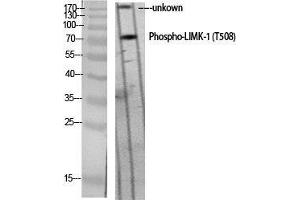 Western Blot (WB) analysis of specific cells using Phospho-LIMK-1 (T508) Polyclonal Antibody. (LIM Domain Kinase 1 antibody  (pThr508))
