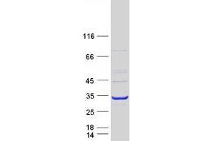 Western Blotting (WB) image for Adenylate Kinase 4 (AK4) (Transcript Variant 5) protein (Myc-DYKDDDDK Tag) (ABIN2714405)
