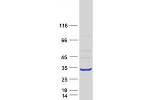 Validation with Western Blot (AK4 Protein (Transcript Variant 5) (Myc-DYKDDDDK Tag))