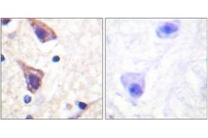 Immunohistochemistry analysis of paraffin-embedded human brain tissue, using TGF beta Receptor II (Ab-250) Antibody.