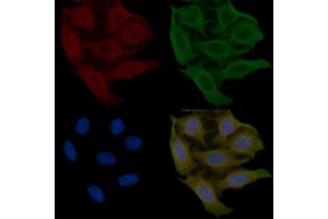 ABIN6260219 and ABIN6266693 staining Hela cells(45 min of heat-shock) by IF/ICC.