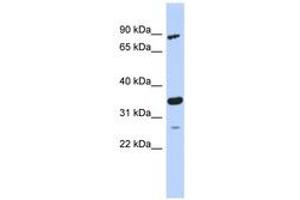 Image no. 1 for anti-PDLIM1 Interacting Kinase 1 Like (PDIK1L) (AA 179-228) antibody (ABIN6743713) (PDIK1L antibody  (AA 179-228))