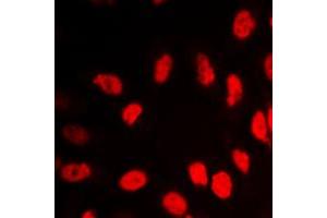 Immunofluorescent analysis of VDR staining in HeLa cells.