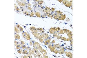 Immunohistochemistry of paraffin-embedded human stomach using OGFR antibody (ABIN6128395, ABIN6145006, ABIN6145007 and ABIN6222871) at dilution of 1:100 (40x lens). (OGFR antibody  (AA 1-280))