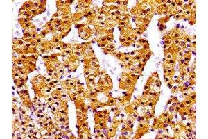 Immunohistochemistry of paraffin-embedded human adrenal gland tissue using ABIN7161727 at dilution of 1:100 (NPC1 antibody  (AA 23-269))