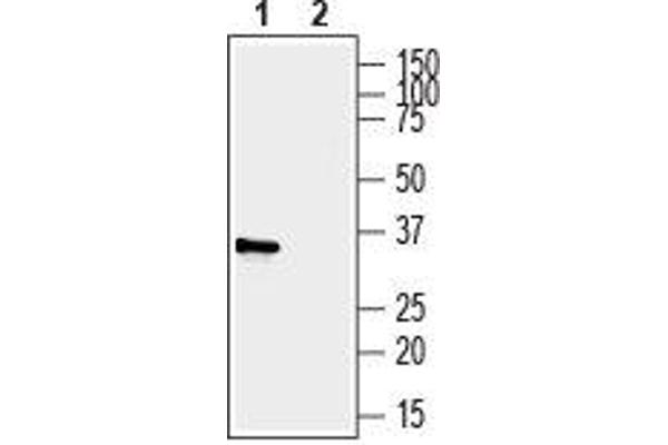 P2RY6抗体（第二胞外环）