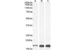 (ABIN184738) (1 μg/mL) staining of Human Frontal Cortex (A) Mouse Brain (B) and Rat Brain (C) lysate (35 μg protein in RIPA buffer).
