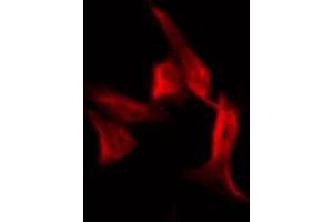 Immunofluorescence (fixed cells) (IF/ICC) image for anti-Insulin Receptor Substrate 1 (IRS1) (pSer636) antibody (ABIN6255436)