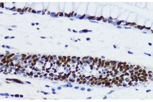 Immunohistochemistry of paraffin-embedded Human colon using Acetyl-Histone H2B-K12 Polyclonal Antibody at dilution of 1:200 (40x lens). (Histone H2B antibody  (acLys12))