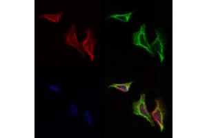 ABIN6258206 and ABIN6274351 staining Hela cells by IF/ICC. (GIT2 antibody  (Internal Region))