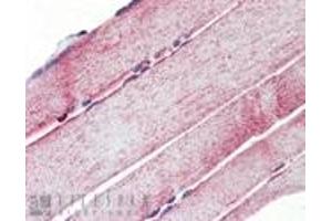 Immunohistochemistry analysis of human skeletal muscle tissue stained with Mn SOD, pAb at 10 μg/mL. (SOD2 antibody)