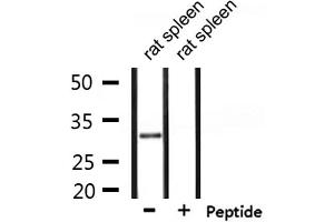 Western blot analysis of extracts from rat spleen, using SMUG1 Antibody. (SMUG1 antibody  (Internal Region))