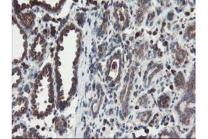 Immunohistochemical staining of paraffin-embedded Human breast tissue using anti-ACBD3 mouse monoclonal antibody. (ACBD3 antibody)