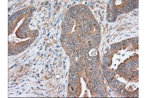 Immunohistochemical staining of paraffin-embedded Human prostate tissue using anti-SNX9 mouse monoclonal antibody.